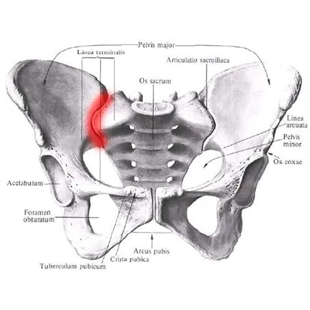 Osteitis